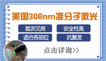 脸上皮肤长一小块白斑
